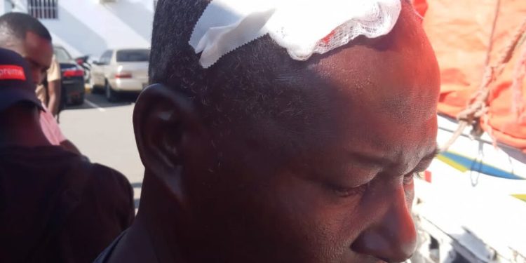 Camionero resulta herido tras haitianos lanzar piedras en puerta fronteriza