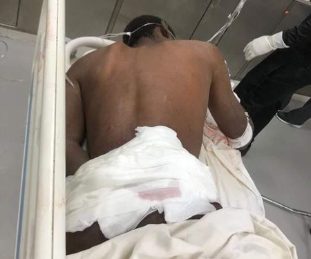 Hieren haitiano de cartuchazo en disputa por 500 pesos en Gozuela Montecristi