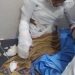 Fallece joven resultó con quemaduras en Dajabón 