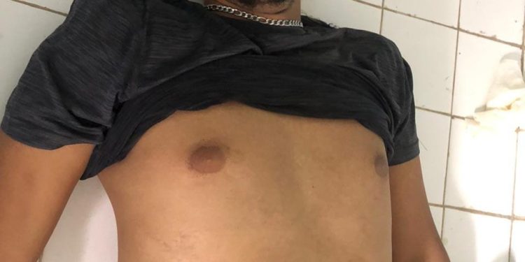 Supuesto militar mata joven de un disparo en Loma de Cabrera Dajabón