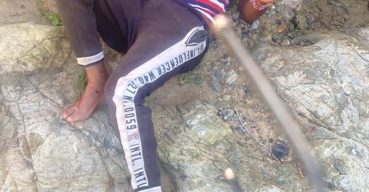 Accidente; Caída de camión al fondo del rio guayubin deja tres persona heridas de consideración