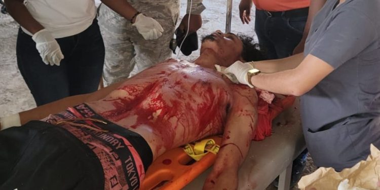 Pleito a botellazos deja un herido de gravedad en Playa La Ensenada