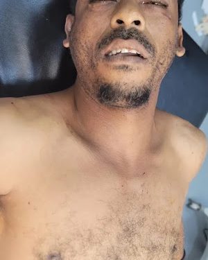 Matan hombre y dejan otro herido de balas en Montecristi