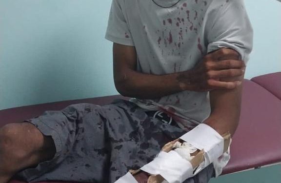 Apresan a tres presuntos integrantes de bandas juveniles en Santiago Rodríguez