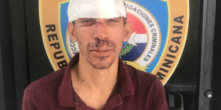 La policía apresa por supuesto robo al “el Peregrino» Jairo Rivas de Dajabón