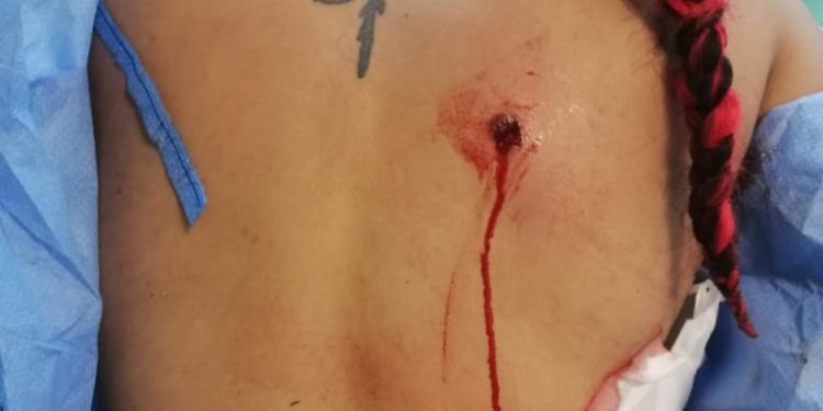Hieren mujer de un balazo en la espalda durante trifulca en El Javillar