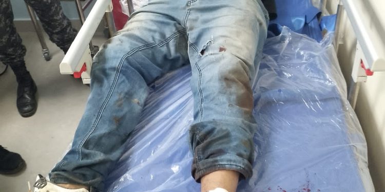 Presunto “delivery” resulta herido al intentar desarmar agente policial  