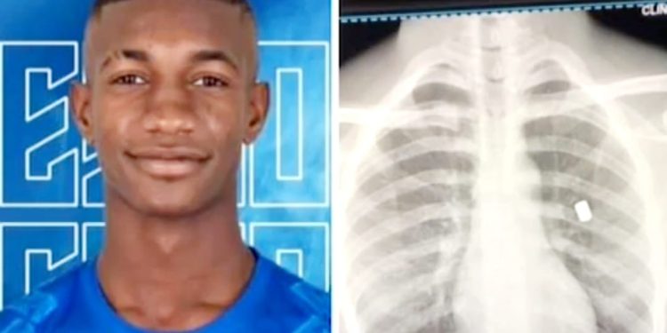 Se complica situación de salud joven deportista baleado por asaltantes en Puerto Plata