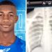 Se complica situación de salud joven deportista baleado por asaltantes en Puerto Plata