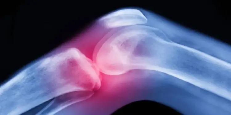 Hallan una hormona que fortalece los huesos y podría ayudar a tratar problemas óseos