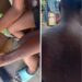Alertan en comunidad de Loma de Cabrera por supuesta presencia de viruela del Mono
