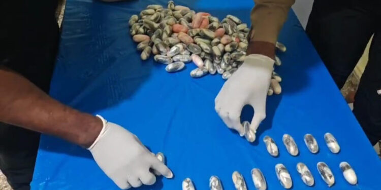 Arrestan a nigeriano con 134 bolsitas de cocaína en el estómago