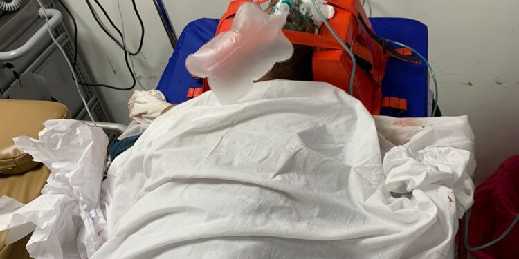 Accidente de tránsito deja un muerto y un herido en comunidad de Dajabón  