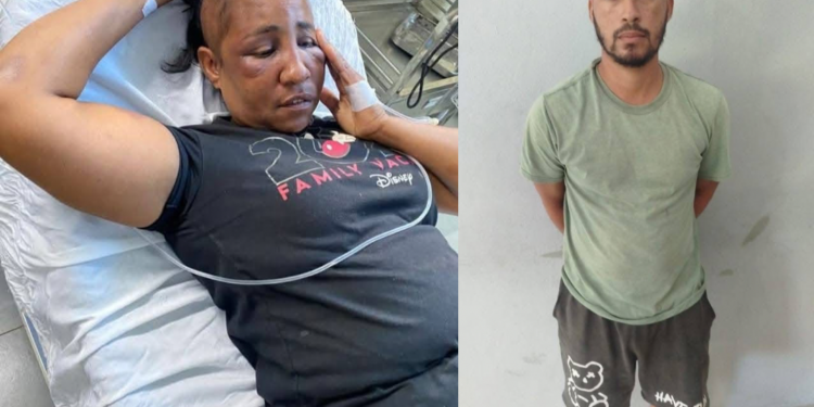 Hombre agrede a una mujer y le corta el cabello en Luperón; permanece ingresada en centro de salud
