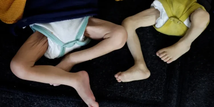 Aumenta a 100 el número de niños muertos por desnutrición en Gaza