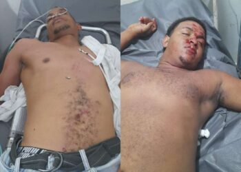 Dos jovenes resultan heridos anoche en carretera los Miches Dajabón