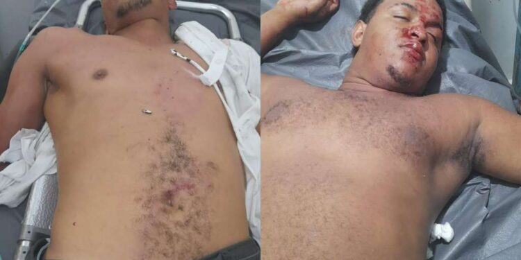 Dos jovenes resultan heridos anoche en carretera los Miches Dajabón