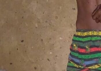 Fallece haitiano ultimado de manos de compatriota suyo en Castañuelas Montecristi