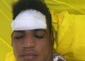 Chofer de camión de bomberos resulta con fracturas y heridas al choca con vaca mientras cubría emergencia en Castañuelas