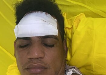 Chofer de camión de bomberos resulta con fracturas y heridas al choca con vaca mientras cubría emergencia en Castañuelas